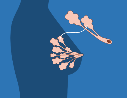 Diagram showing normal cells and abnormal cells